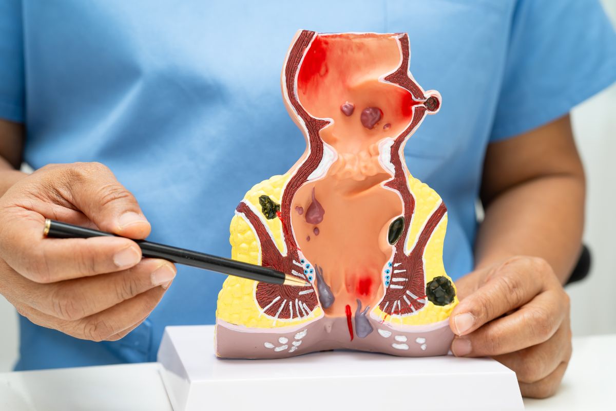 Primeira consulta com o proctologista: como é o exame e o que levar ...